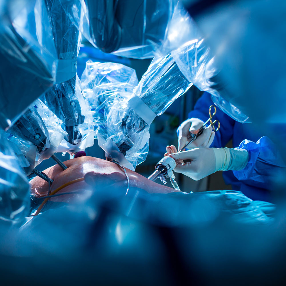 Robotic surgical arms and instruments in the operating theatre.